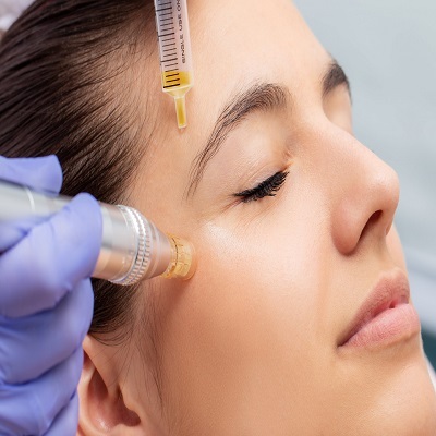 Mesotherapy in Dubai